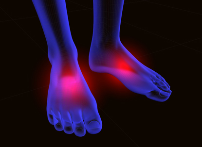 Peripheral Neuropathy